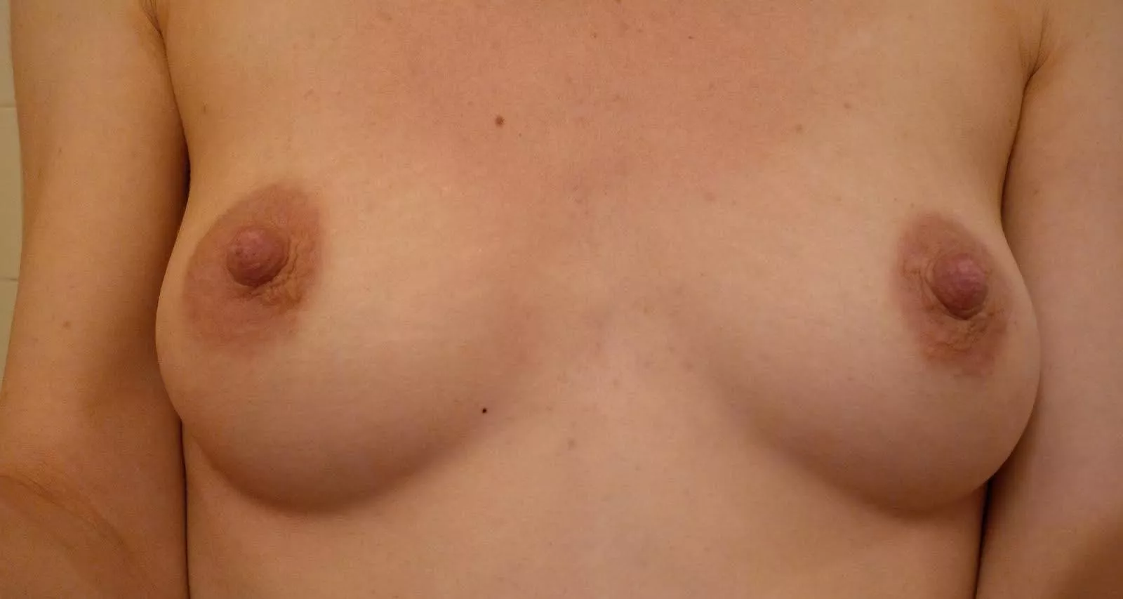 Detailed photo of my boobs😛your opinion?
