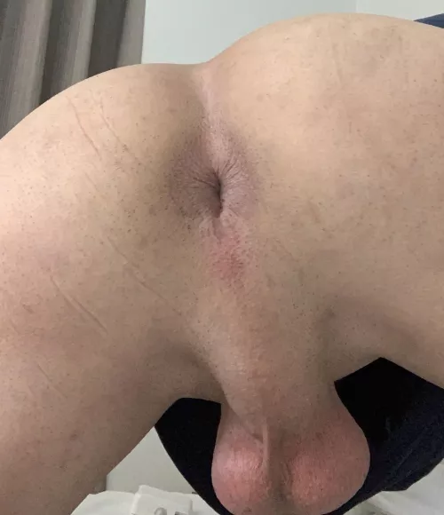 Low hanging from the back. Rate?