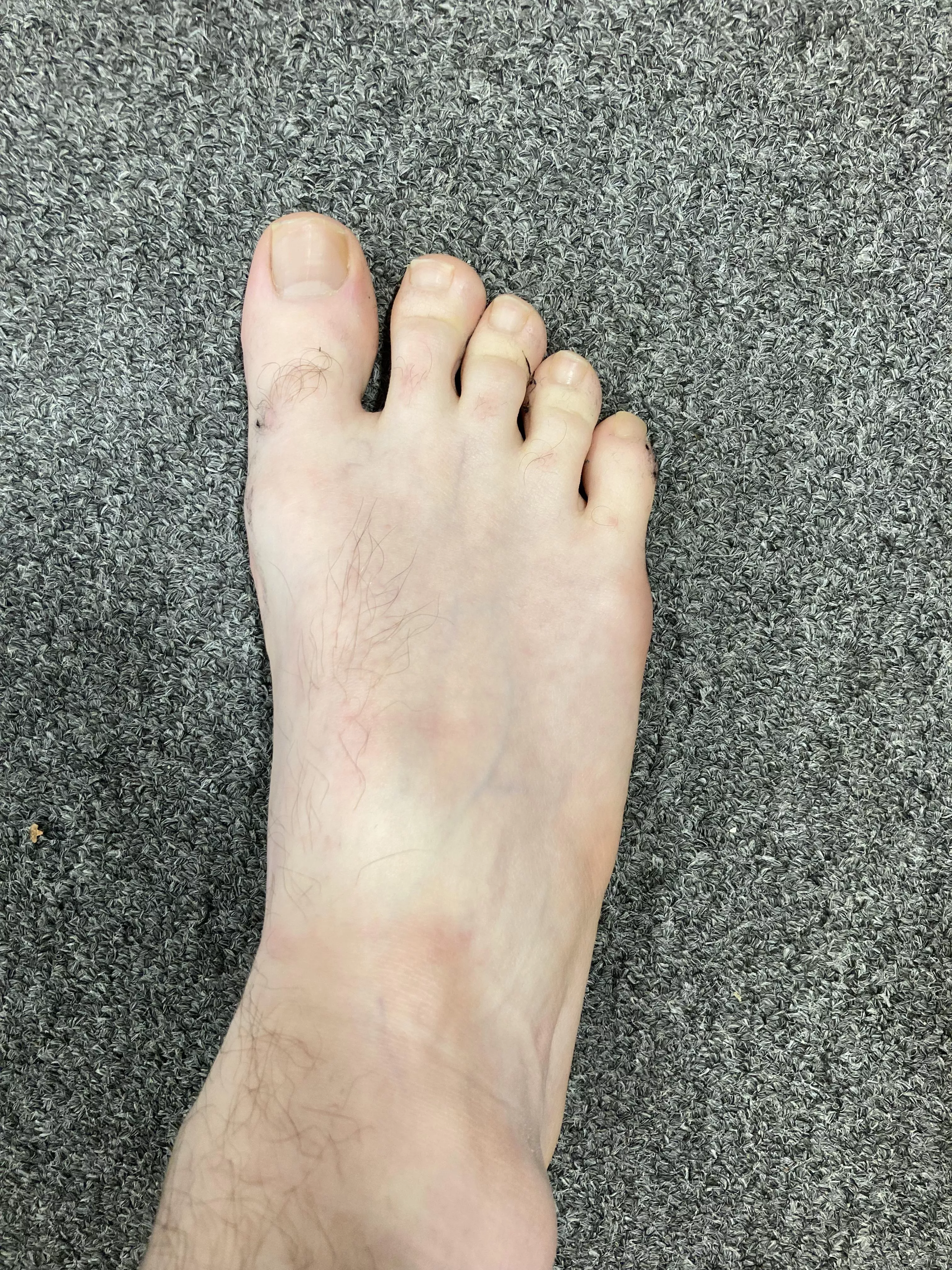 Resting my sweaty feet at work