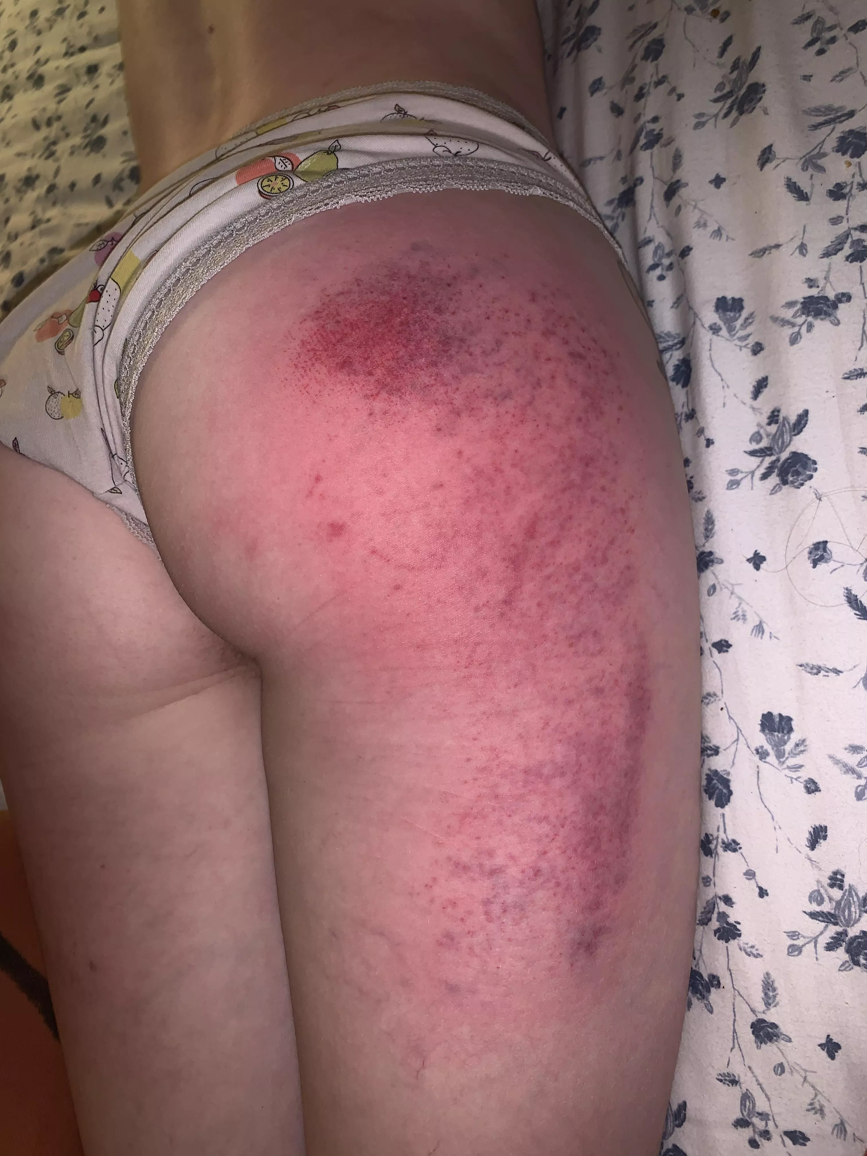 Trying all the implements <3 see what sticks