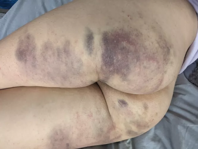 Turning nice and purple :)