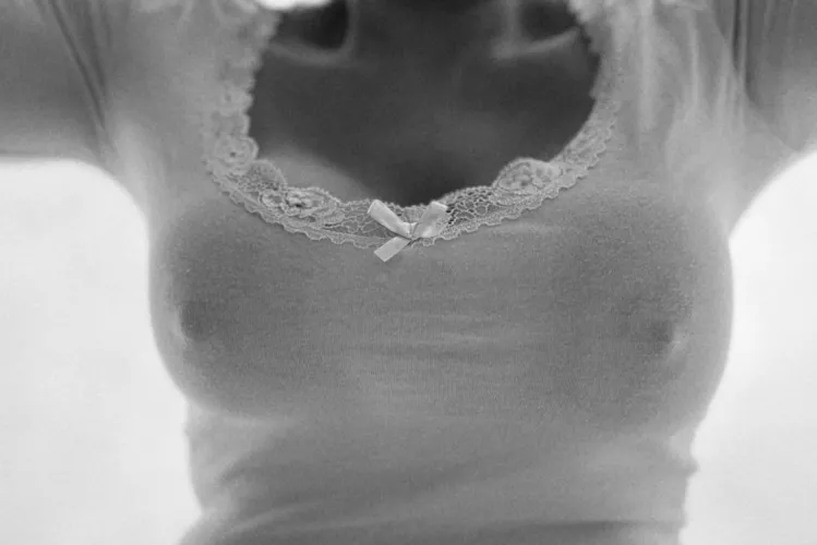 A view from below. (F)