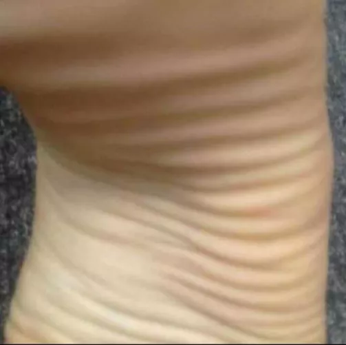 I hope you like my wrinkles