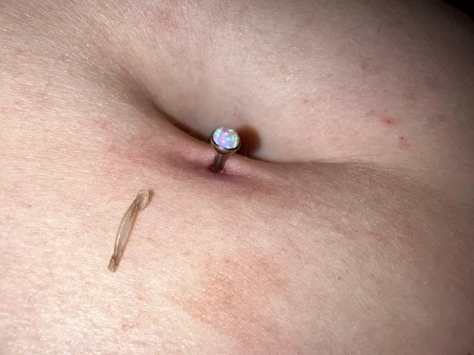 Belly piercing skin thing?!?
