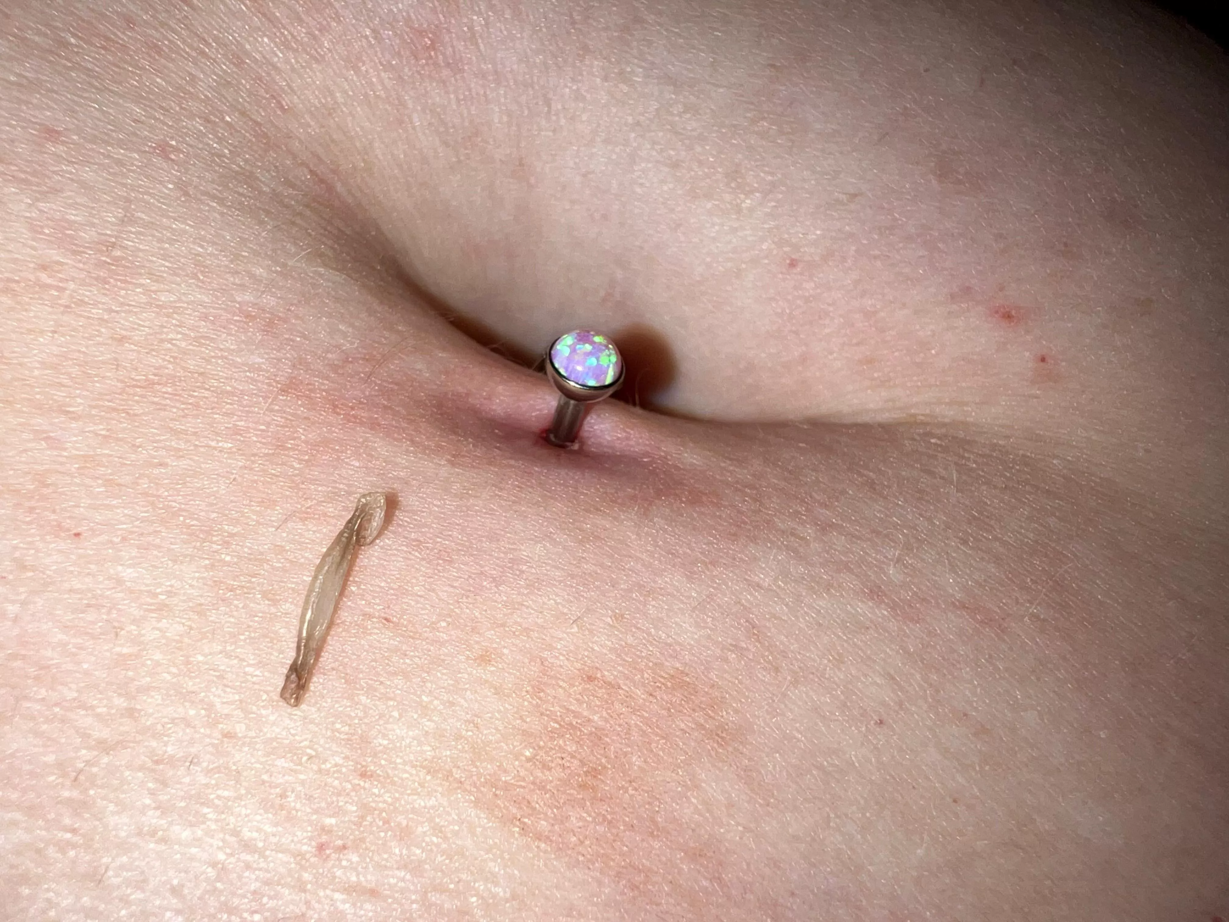 Belly piercing skin thing?!?