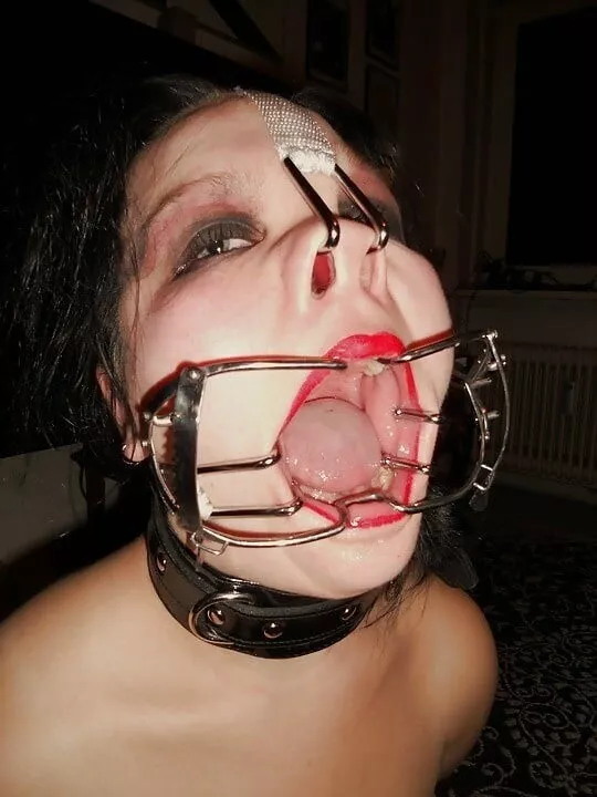 Extra wide [xpost /r/MouthRetractor]