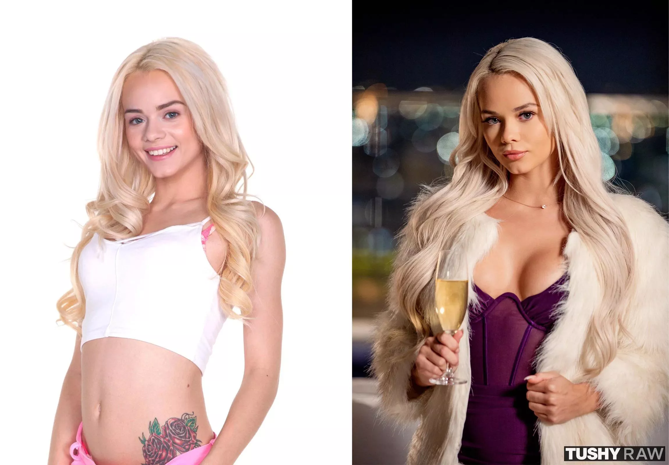 How Good She has been after Surgery ❤️❤️❤️She become very beautiful after surgery