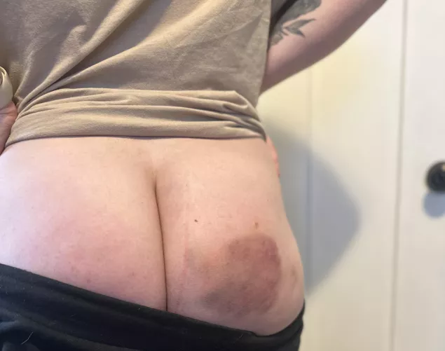I love it when daddy bruises my pretty ass.