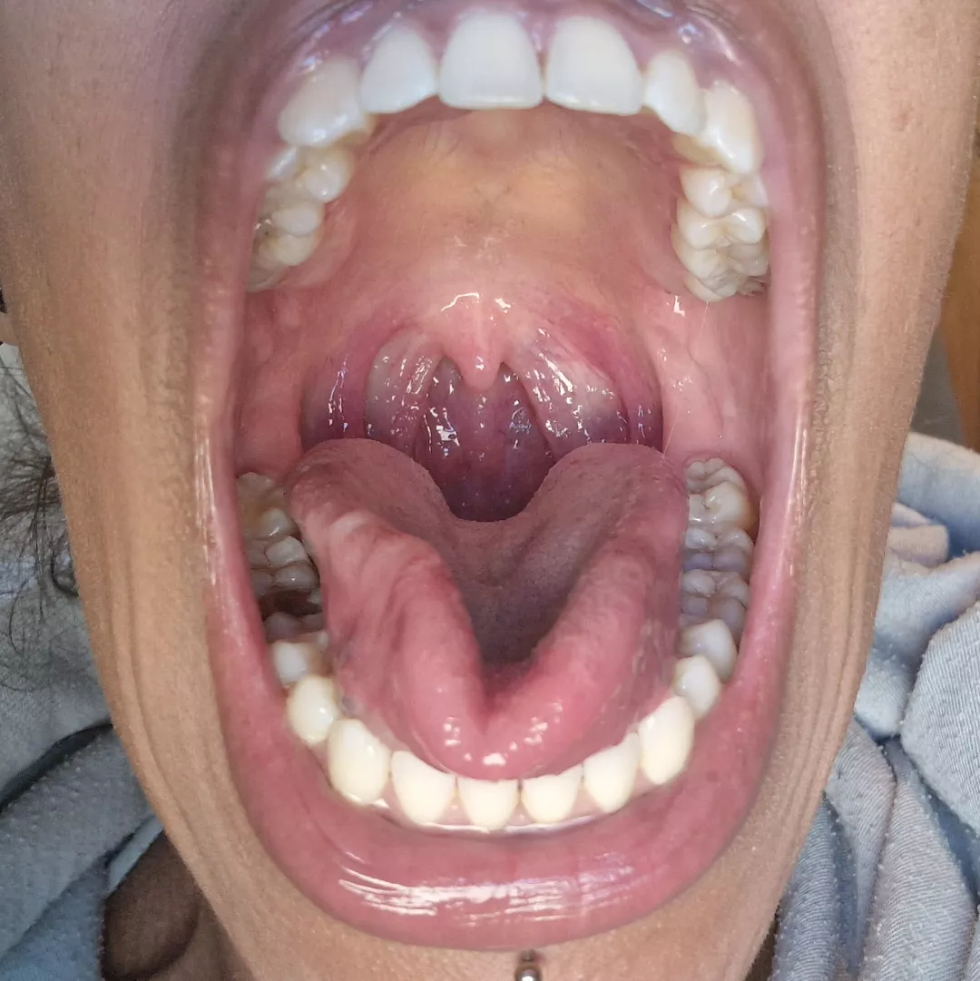 It's as wide as I can get it.