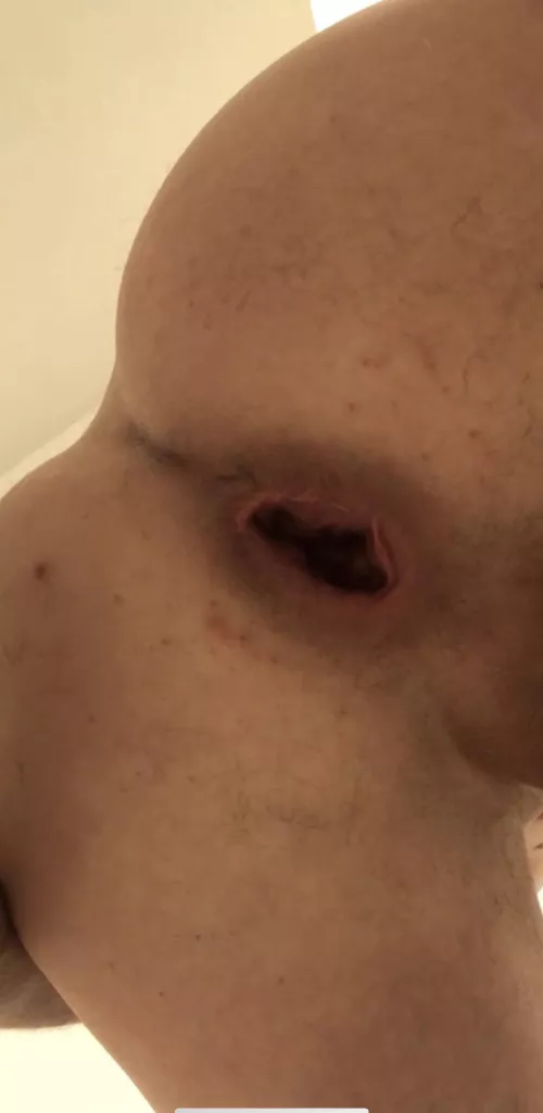 Just after a 3” plug