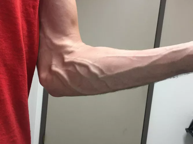 Kinda out of hand tbh