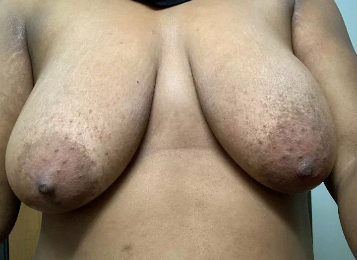 Not bad for being 51 yr old boobs