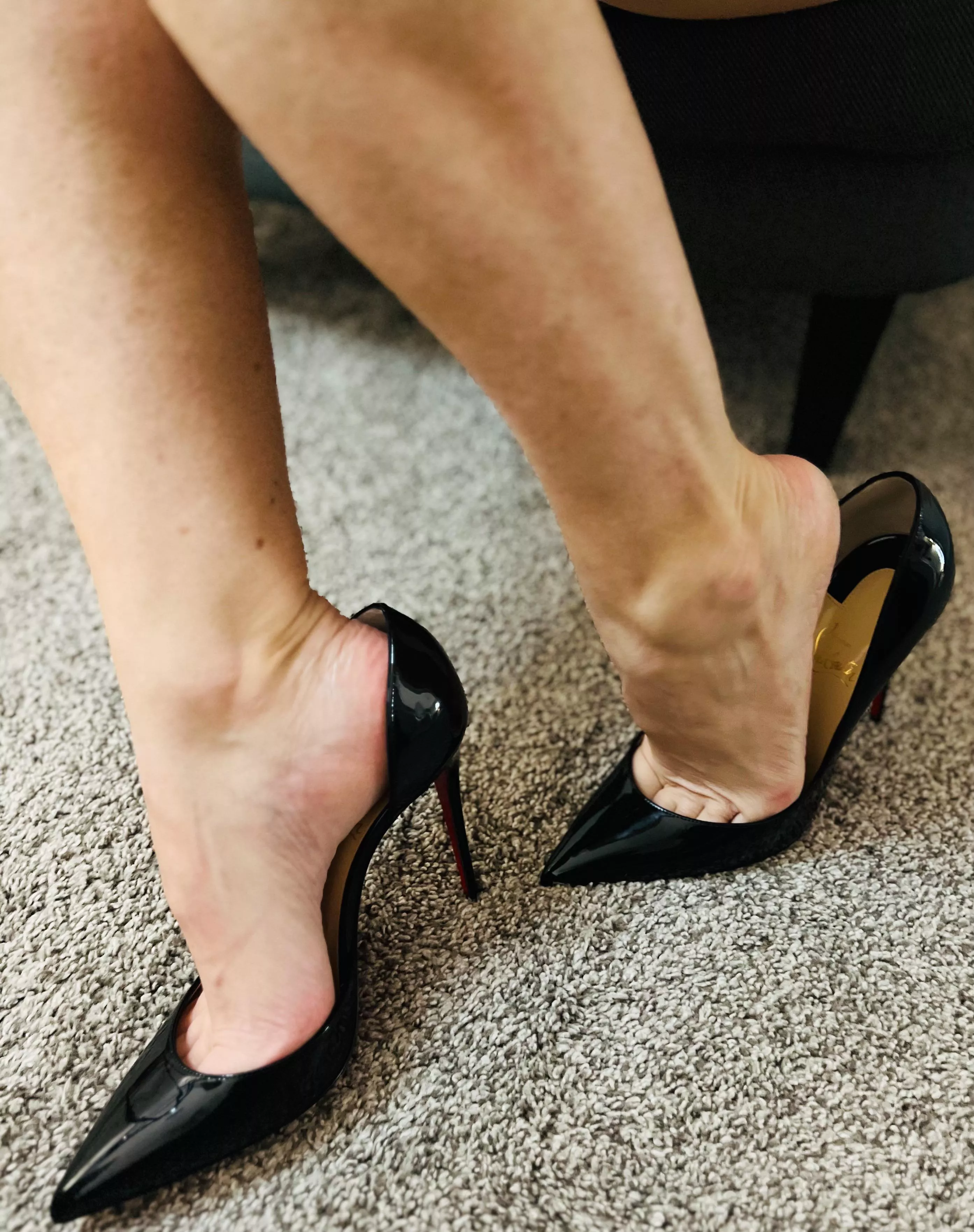 Open sides and high arches…