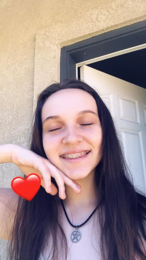 Sometimes my braces make me feel extra cute