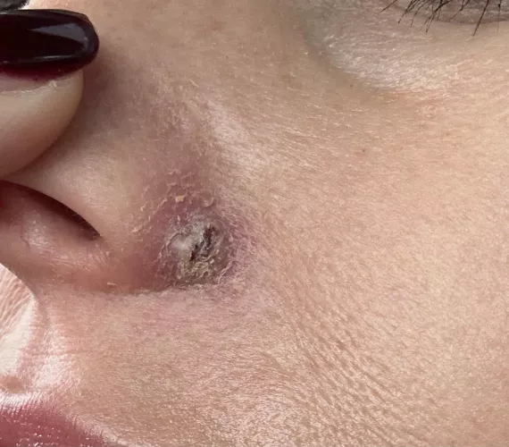 What can I do about this