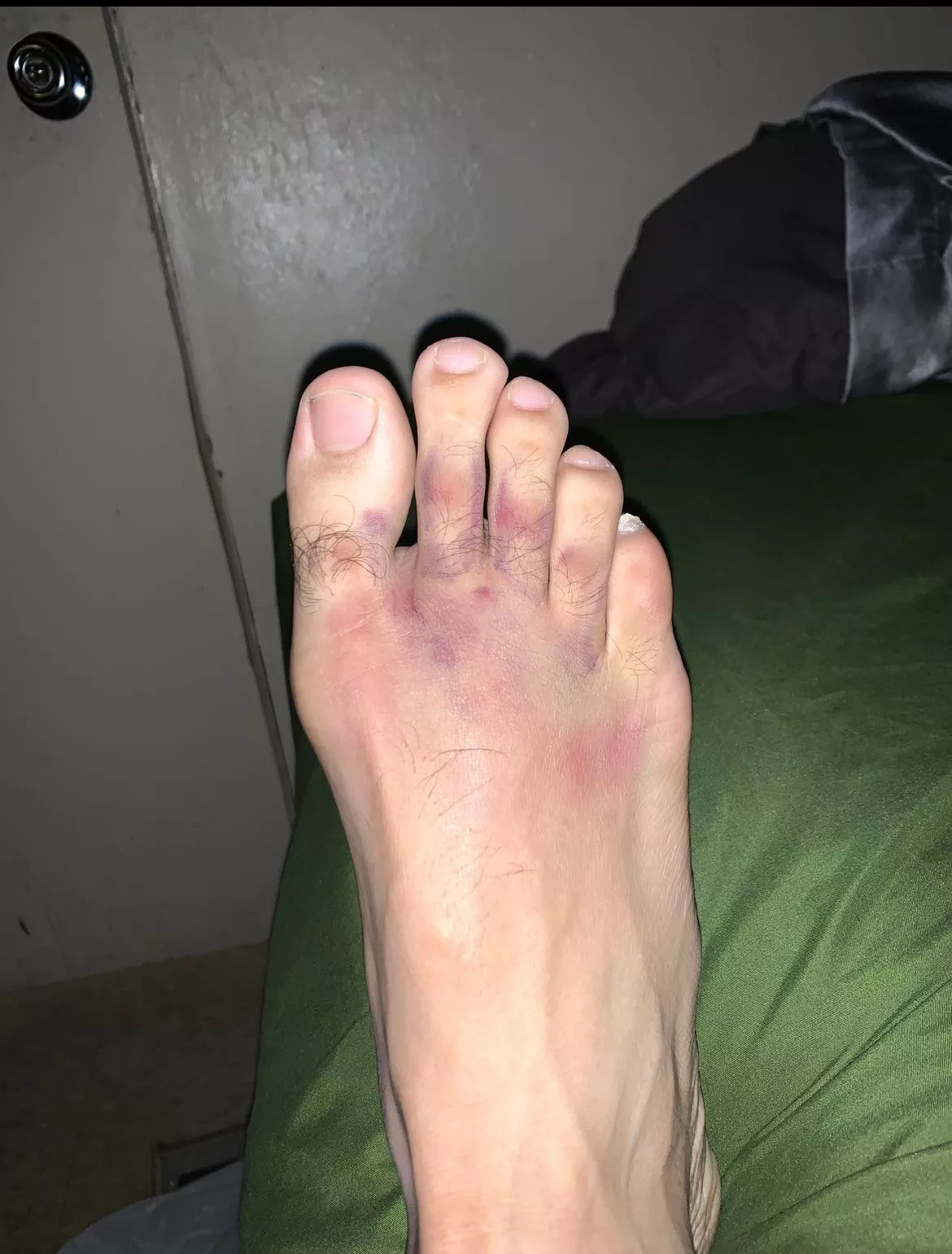 Who likes ? I got hurt