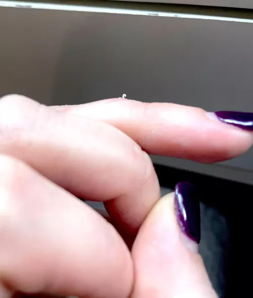 My reoccurring knuckle pimple