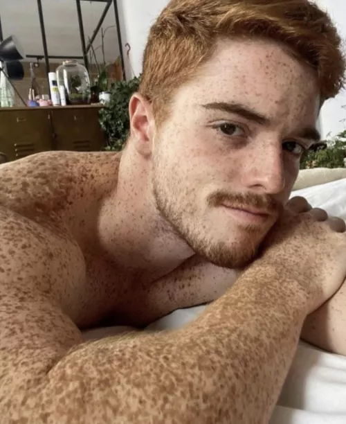 Are you into Freckled Gingers?
