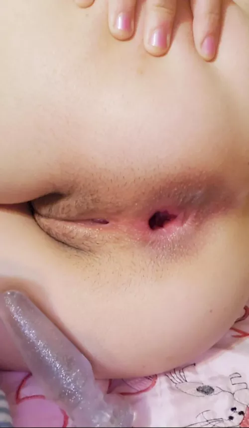 is it altered enough? (18F)