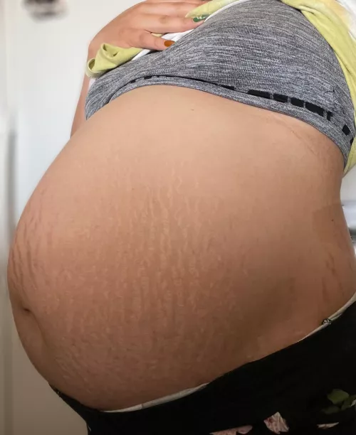 So stretched out 🙈🤰🏻