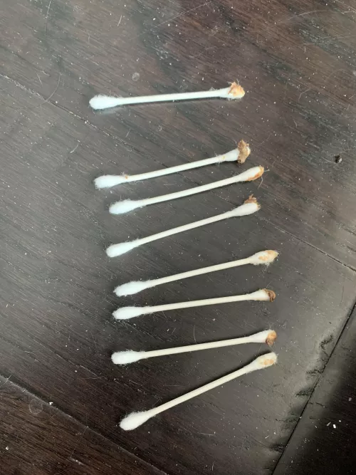 I cleaned out my dogs ears