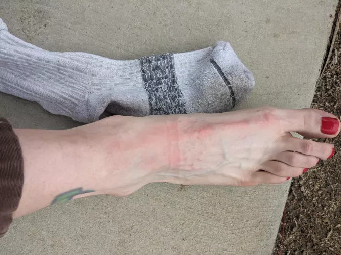 The stitching on the inside of this sock left an imprint on my foot from skating in them. This pair has over 9 hours of skate time So far. [selling]