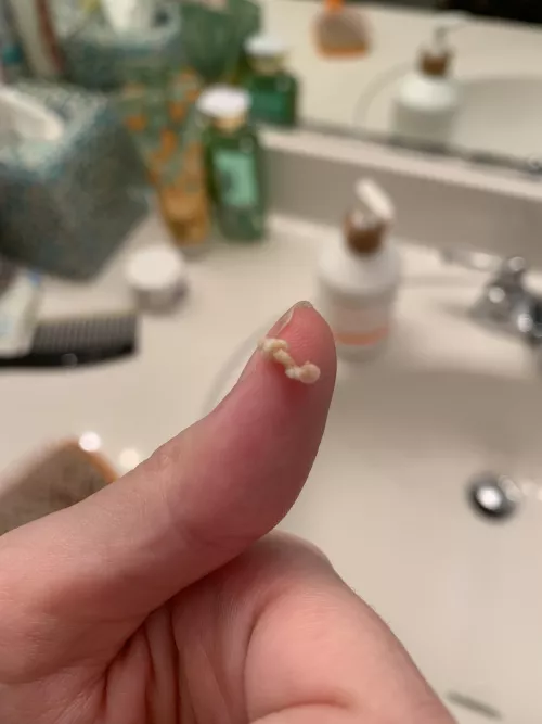 This just came out of my dog