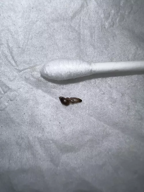 1st submission! (Blackhead Pop)