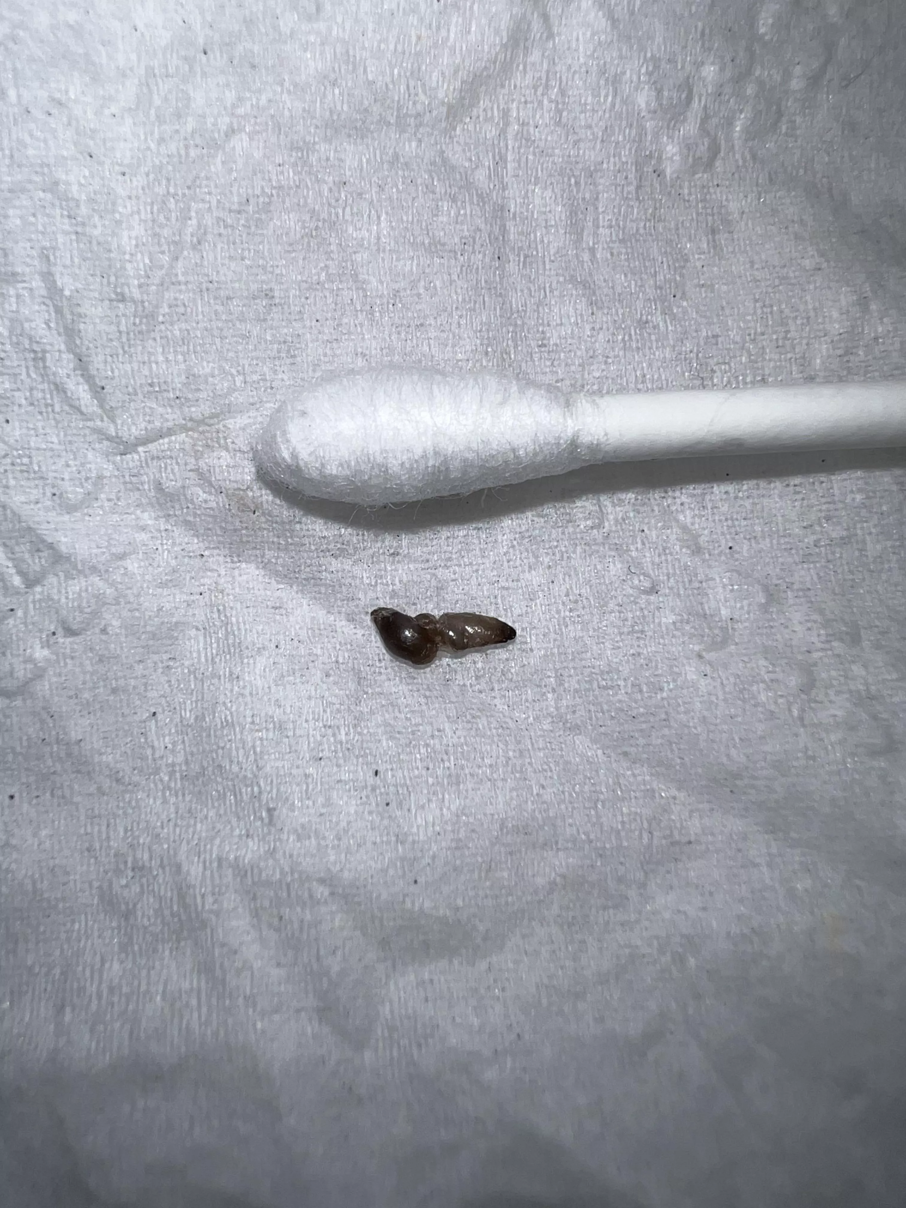 1st submission! (Blackhead Pop)