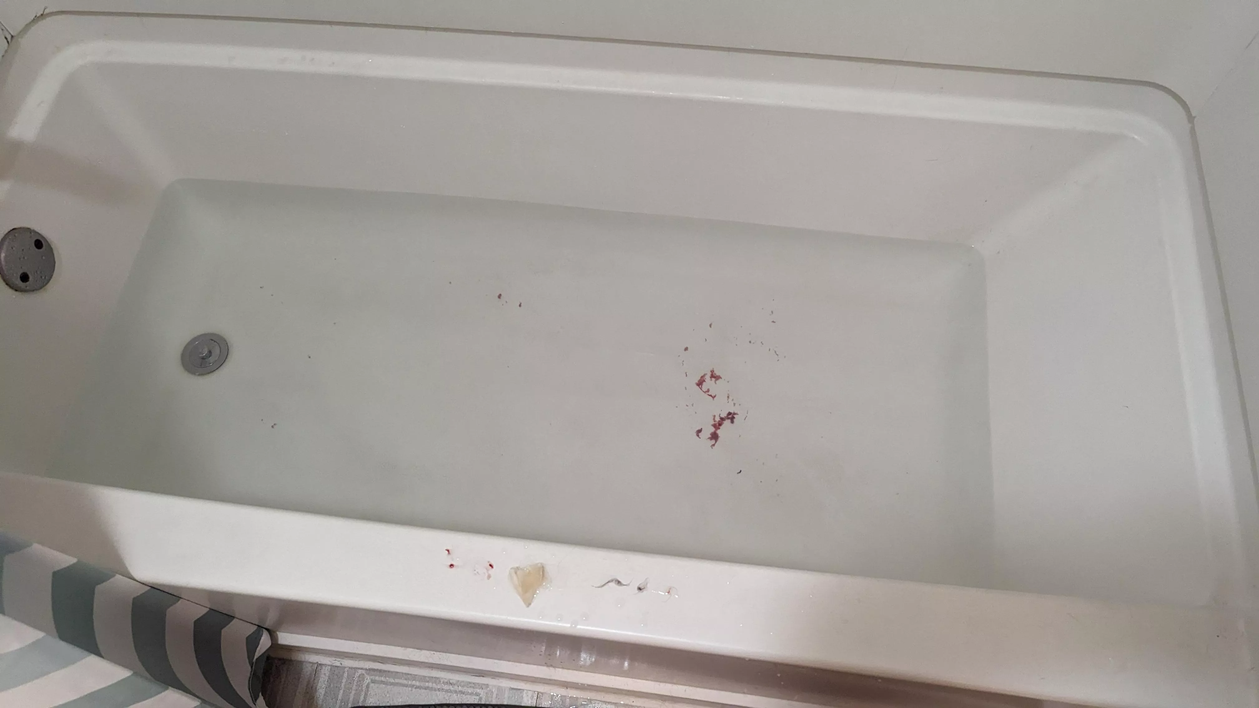 Pilonidal Cyst became infected and painful last week. Popped yesterday. This is just squeezing the crud out. Round 1 of many.