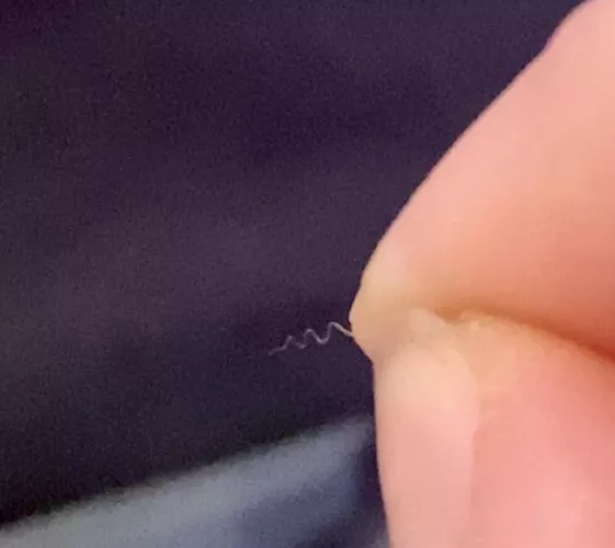 I get the craziest igrowns on my thighs from keratosis pilaris. the unreal zig zag pattern 😭