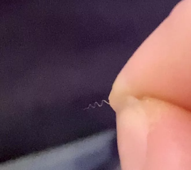 I get the craziest igrowns on my thighs from keratosis pilaris. the unreal zig zag pattern 😭