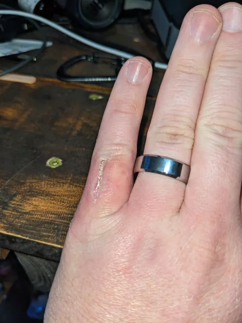 It is technically popping related. A Follow up.