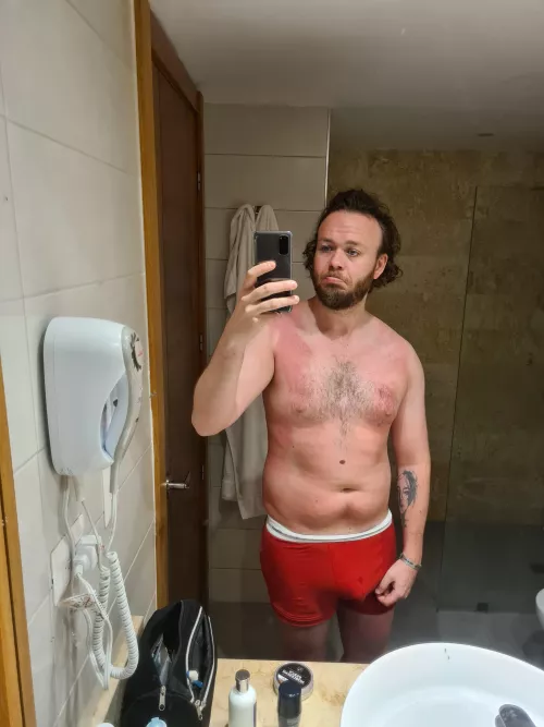 (m) A pretty sunburned semi chubby body 😂