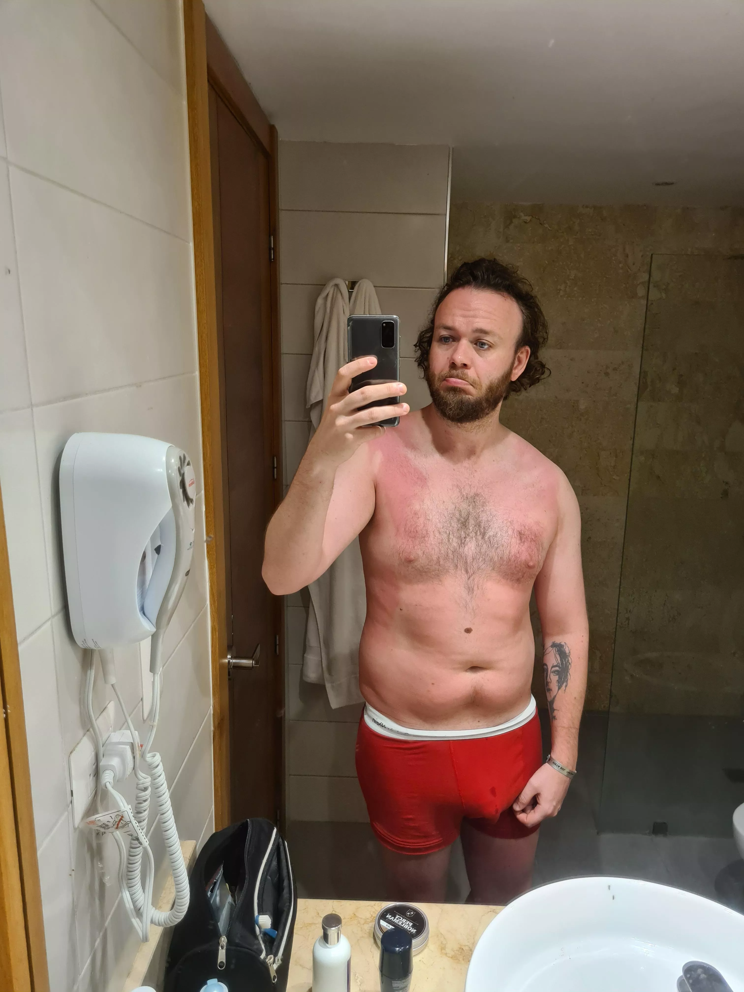 (m) A pretty sunburned semi chubby body 😂