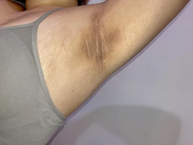 Sometimes I question why I put deodorant on if I just sweat it off😅 ( yes my pits are naturally this dark.)