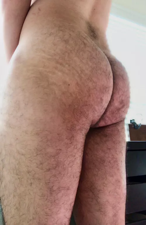 Super self-conscious about my stretch marks