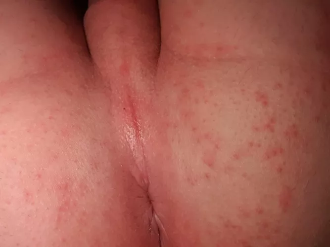 You Kiss my anus? 😊