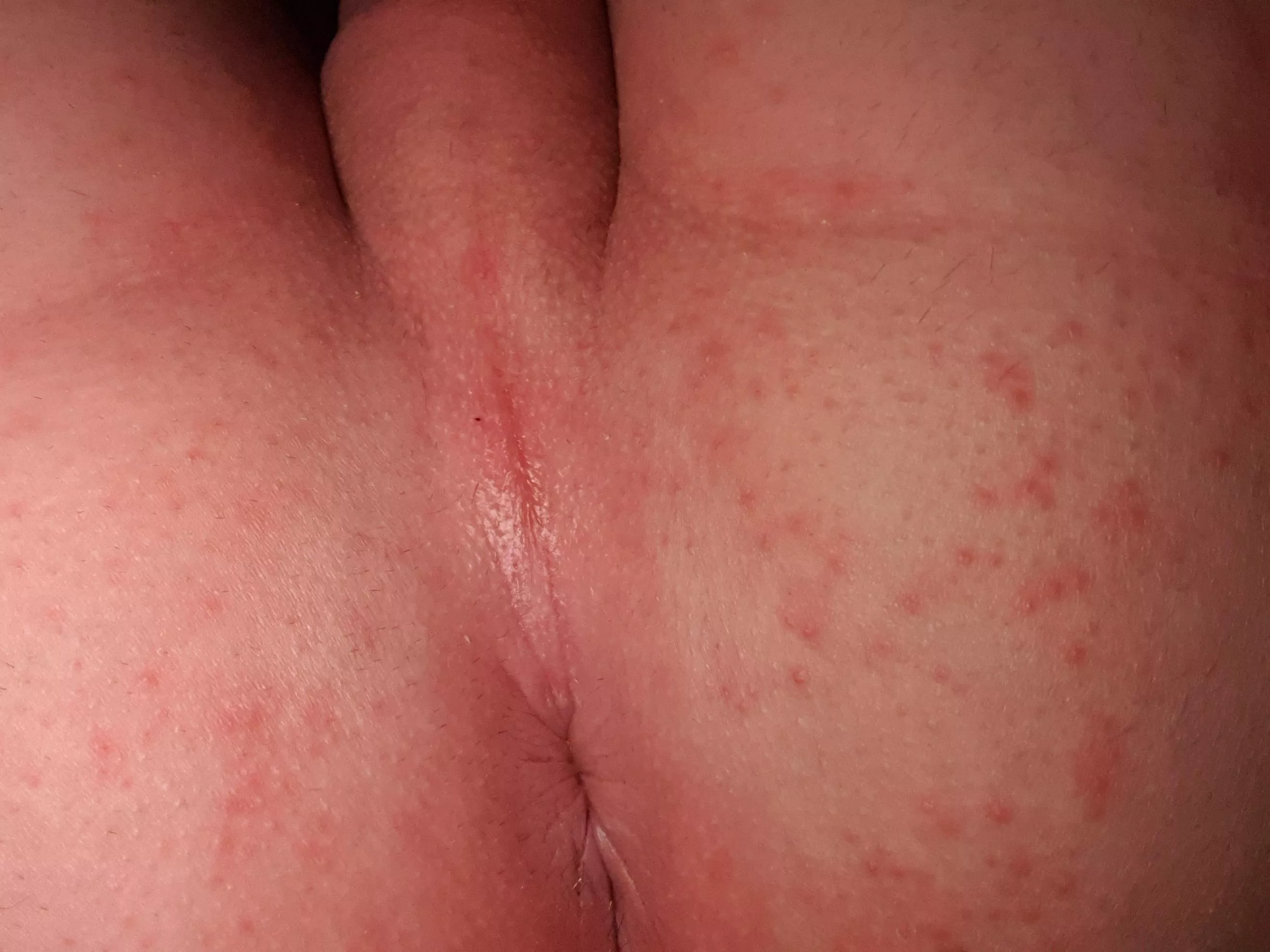 You Kiss my anus? 😊