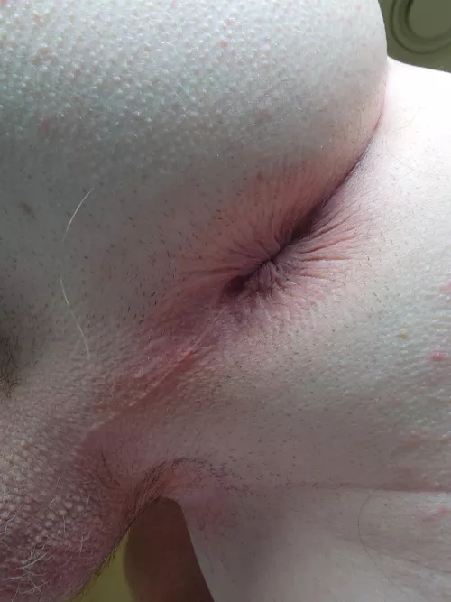 You're finally awake ^_^