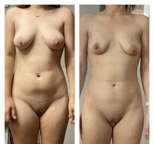 F wondering if i looked better before i lost weight. Right is now left is before