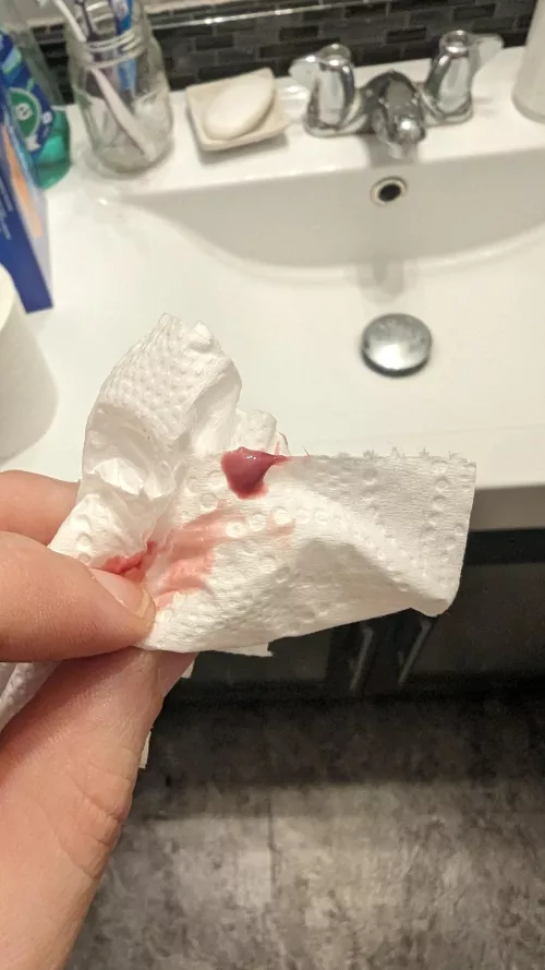 I didn't think it was ready to pop... It was ready to pop.