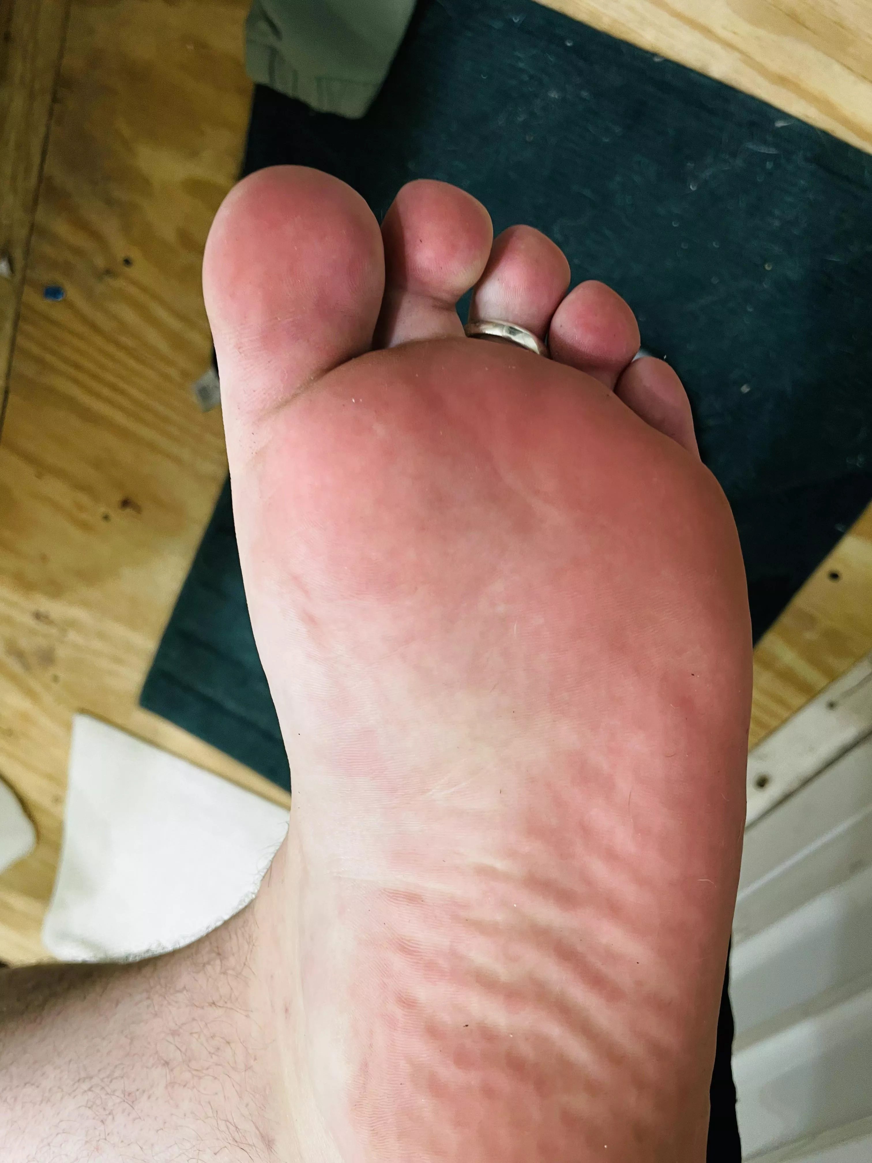My thick sole after wearing slides all day