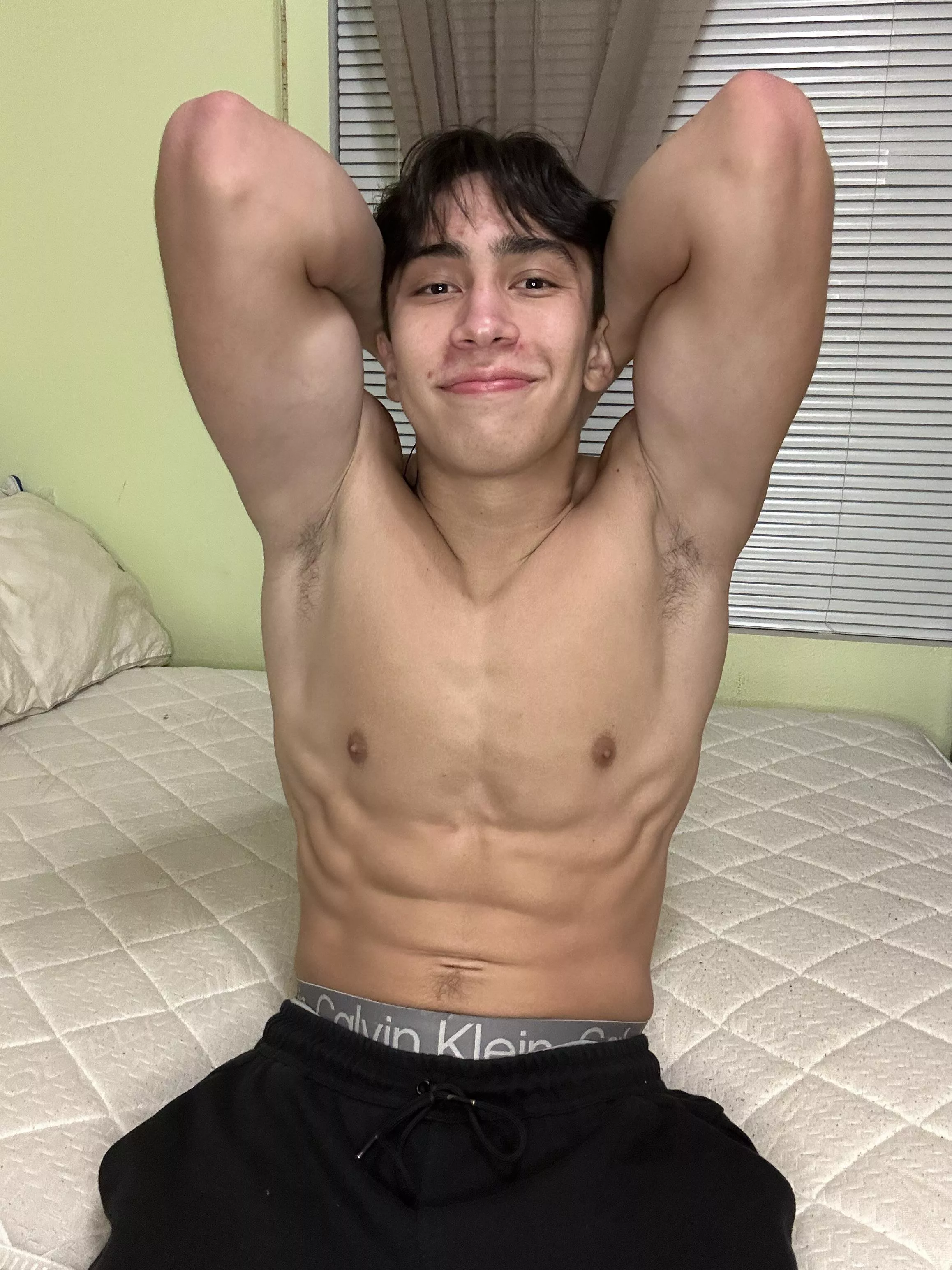 Don’t mind the 3 pimples 😅 skins real bad right now 18