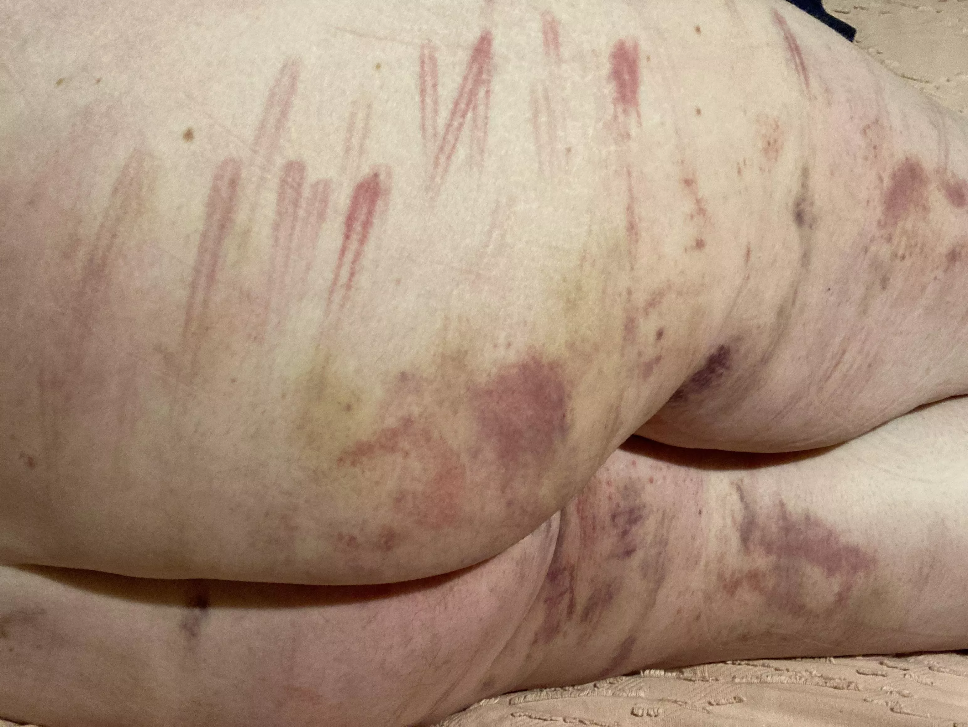 Post impact session cane hand and paddle