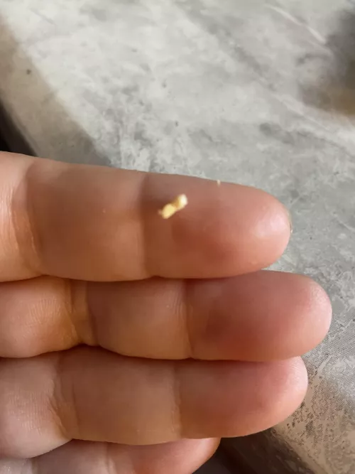 Popped this out of my ear, the relief was heavenly.