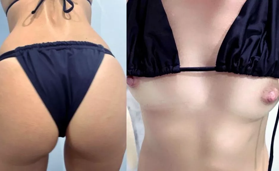 Should I buy this bikini or not..