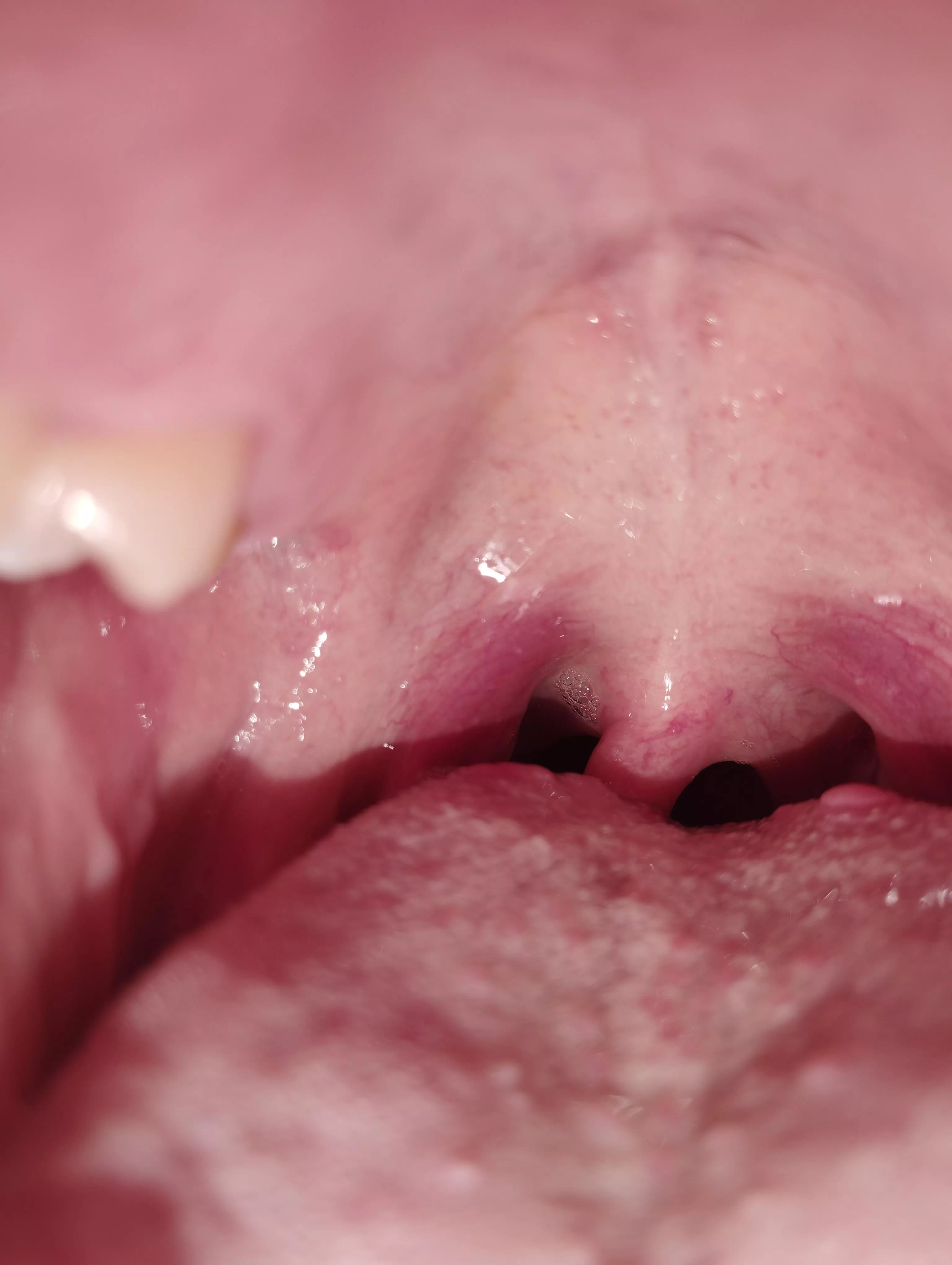 anyone has a mouth fetish here?😋😋