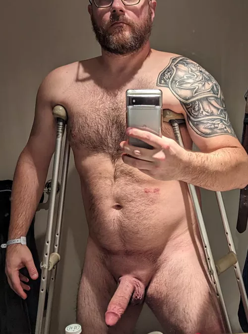 Even knee surgery doesn't make me less horny. Fyi no shirt with crutches is not a good move