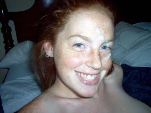 Ginger with freckles